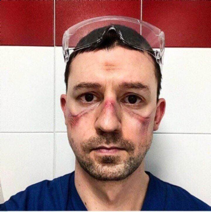 IMAGINE cât o mie de cuvinte: ”Așa arată medicul după un schimb de 12 ore”