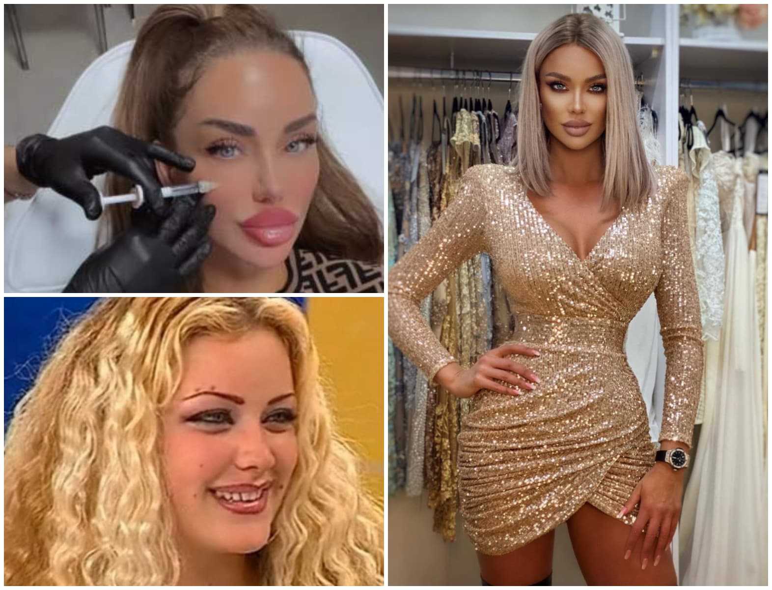 Cea mai importantă investiție pentru Bianca Drăgușanu, pe 2024! Își bagă imaginea ”în reparații”: ”Fața mea a fost stricată!”