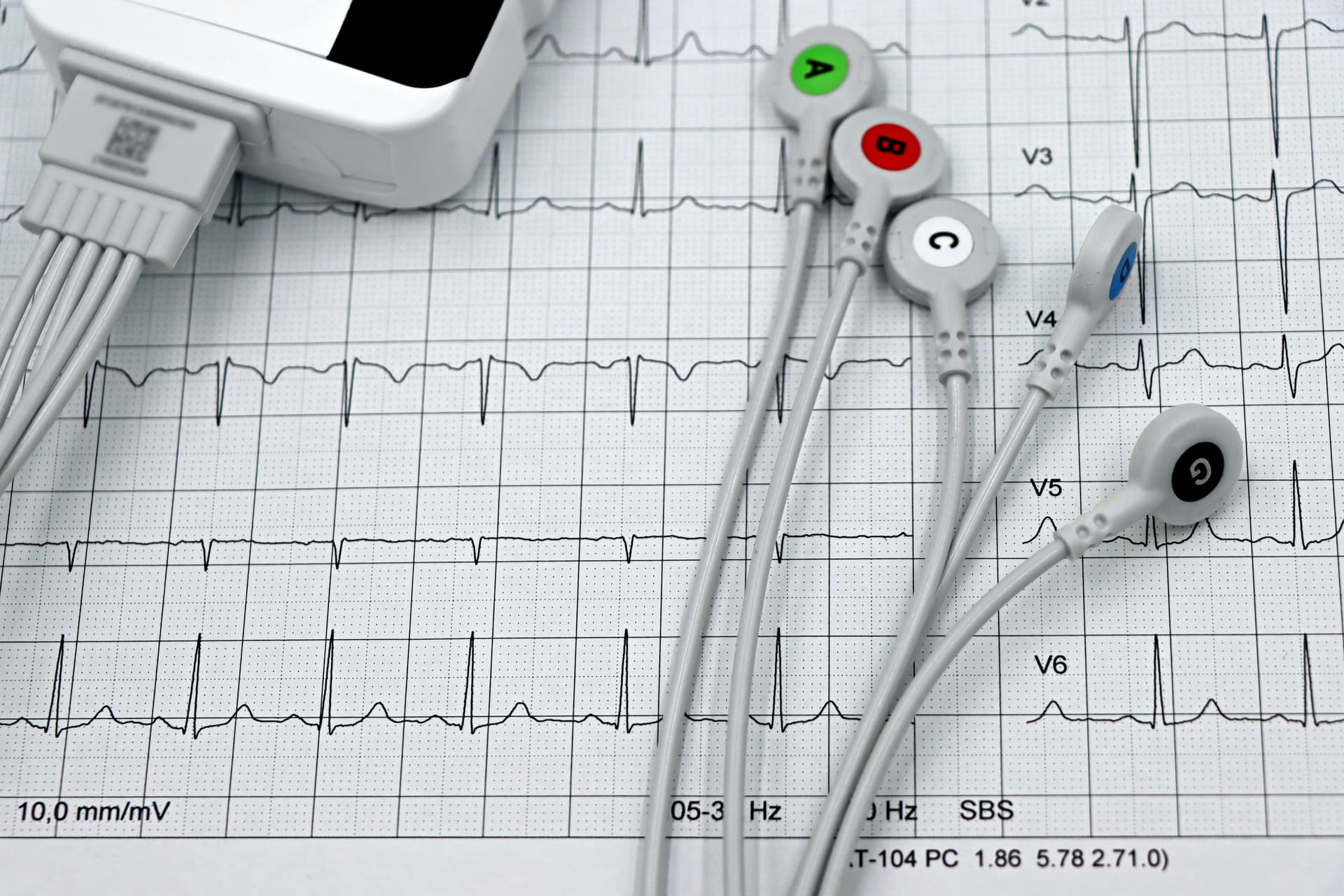 Comisia Europeană cere feedback pentru screening cardiovascular, invocând 1,7 milioane de decese anual în UE