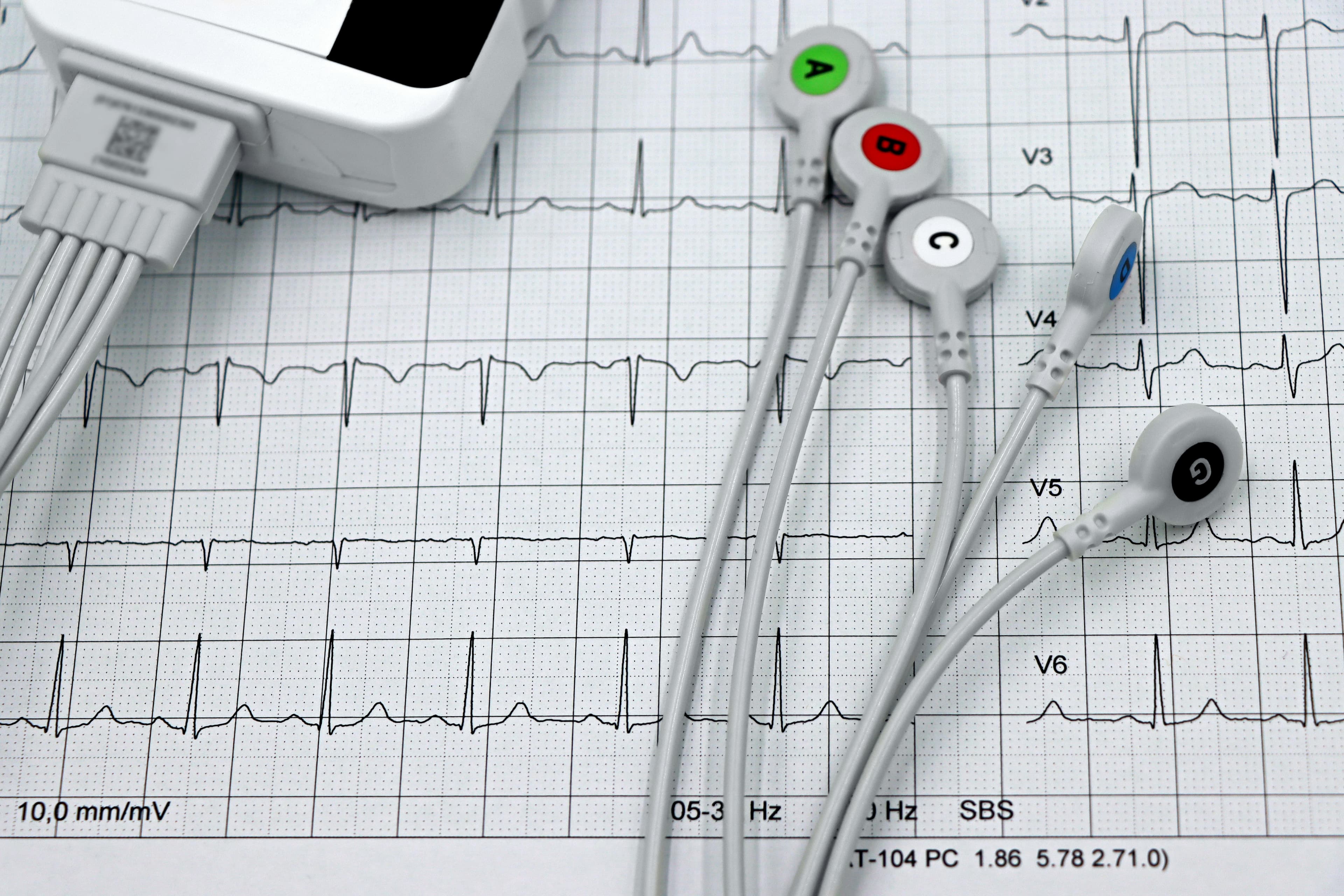 Comisia Europeană cere feedback pentru screening cardiovascular, invocând 1,7 milioane de decese anual în UE