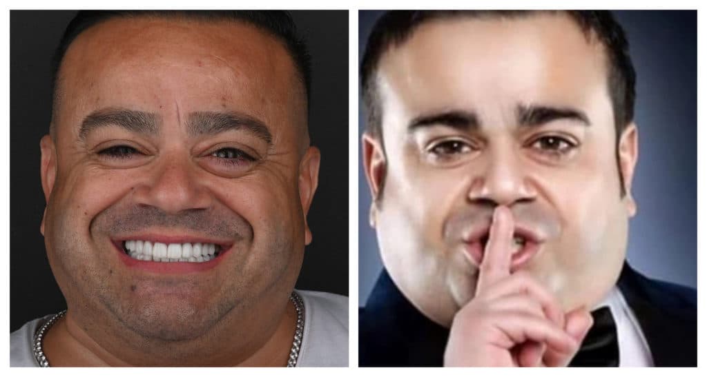Adrian Minune a dat 9000 de euro pentru zâmbet de Hollywood /FOTO! Motiv pentru care și-a mărit și tariful