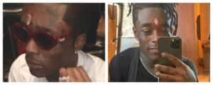 Lil Uzi Vert și-a implantat în frunte un diamanat de 24 milioane $