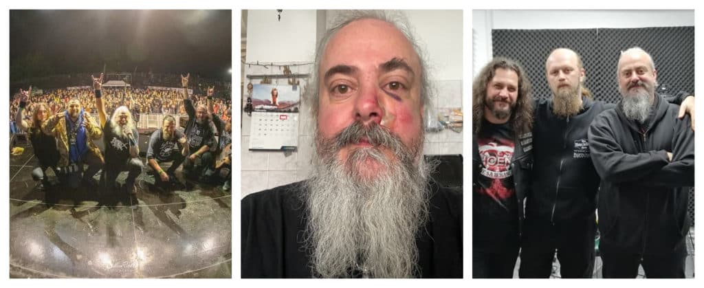 Solistul trupei Bucovina a fost bătut crunt în plină stradă! Florin Țibu a fost lovit cu un obiect metalic în față. ”Fără vorbe, fără tâlhărie, fără nimic”