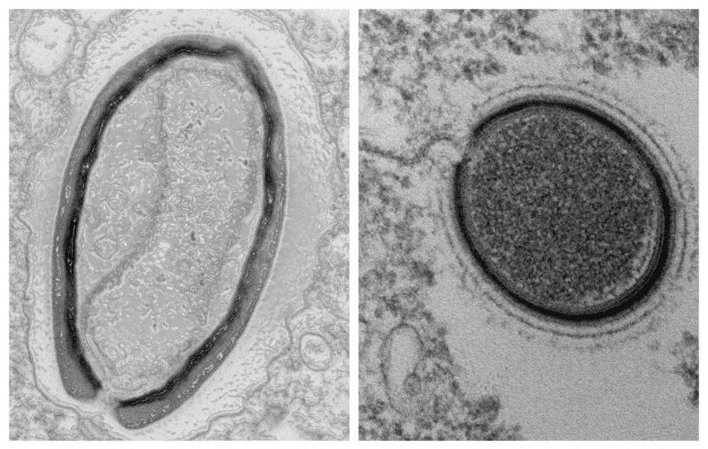 Un „virus zombie” descoperit sub un lac înghețat din Siberia a fost trezit din nou la viață. Cât de periculoși sunt microbii antici