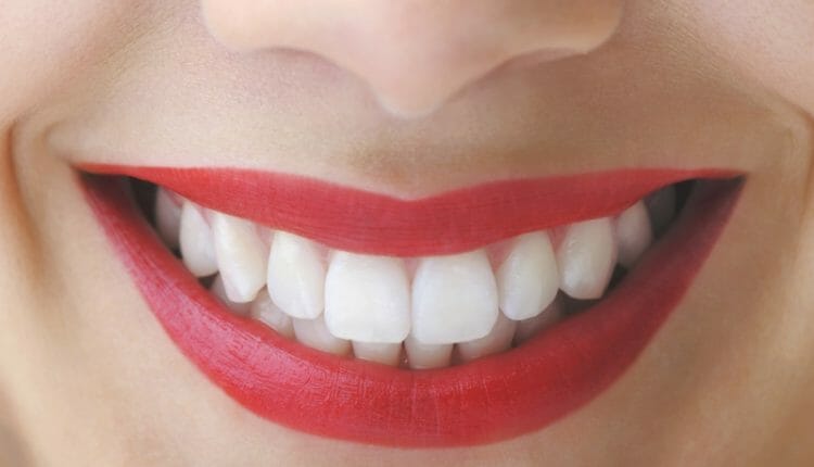 Cum mi-am recuperat zâmbetul de odinioară înlocuind coroanele dentare vechi cu unele noi?