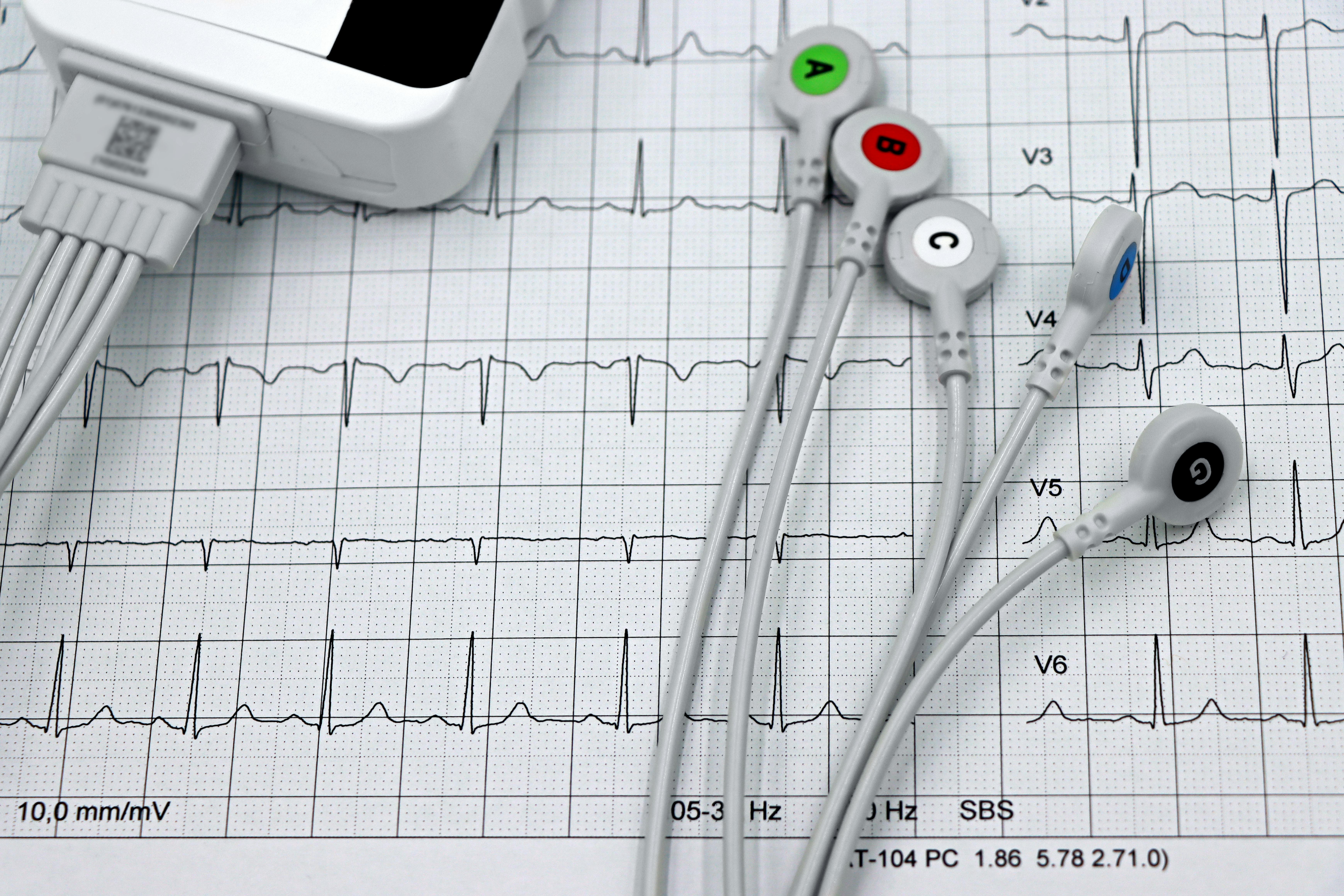 Comisia Europeană cere feedback pentru screening cardiovascular, invocând 1,7 milioane de decese anual în UE